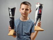 Young Eminem fan gets image of rapper on his prosthetic legs and something brilliant happens