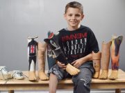 Young Eminem fan gets image of rapper on his prosthetic legs and something brilliant happens